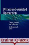 Ultrasound-Assisted Liposuction: Current Concepts and Techniques Garcia Jr, Onelio 9783030268749 Springer