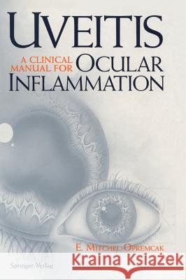 Uveitis: A Clinical Manual for Ocular Inflammation E. Mitchel Opremcak K. Kachelein 9780387942476 Springer Us - książka