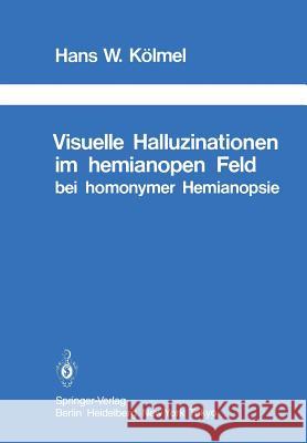 Visuelle Halluzinationen Im Hemianopen Feld Bei Homonymer Hemianopsie Critchley, M. 9783642493140 Springer - książka