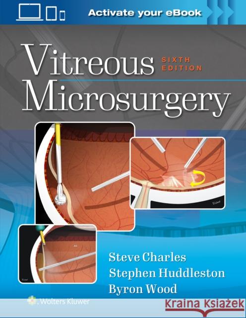 Vitreous Microsurgery Steve Charles   9781975168353 Wolters Kluwer Health - książka