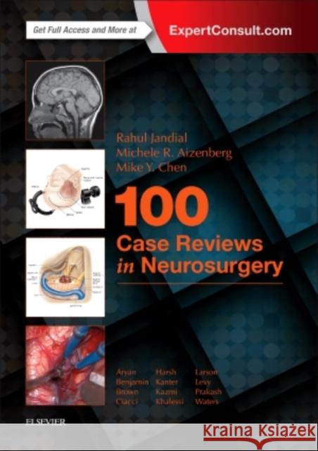 100 Case Reviews in Neurosurgery Rahul Jandial Michele R. Aizenberg Mike Y. Chen 9780323356374 Elsevier - książka
