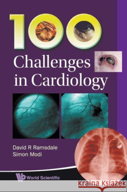 100 Challenges in Cardiology Ramsdale, David R. 9789814307147 World Scientific Publishing Company - książka