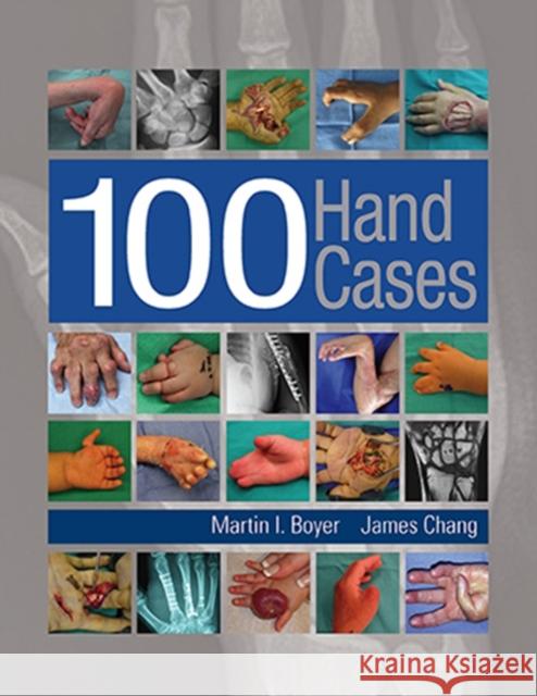 100 Hand Cases Boyer, Martin 9781626236608 Thieme Medical Publishers Inc - książka
