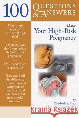 100 Q&as about Your High-Risk Pregnancy Platt, Elizabeth S. 9780763755737 Jones & Bartlett Publishers - książka