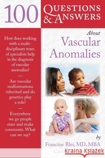 100 Question & Answers about Vascular Anomalies Blei, Francine 9780763766597 Jones & Bartlett Publishers - książka