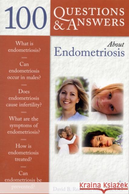 100 Questions & Answers about Endometriosis Redwine, David B. 9780763759230  - książka