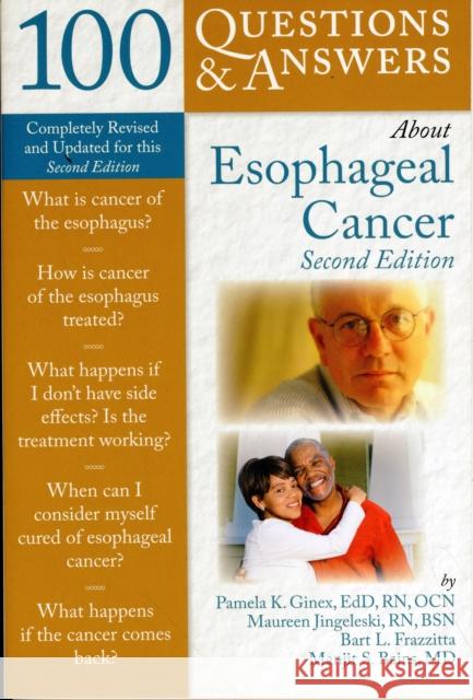 100 Questions & Answers about Esophageal Cancer Ginex, Pamela K. 9780763760526 Jones & Bartlett Publishers - książka