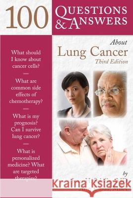 100 Questions & Answers about Lung Cancer Schiller, Joan H. 9781449687571 Jones & Bartlett Publishers - książka