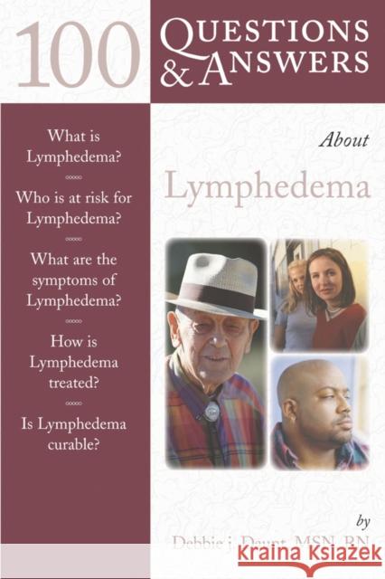 100 Questions & Answers about Lymphedema Thiadens, Saskia R. J. 9780763749897  - książka