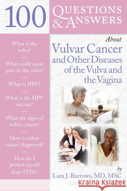 100 Questions & Answers about Vulvar Cancer and Other Diseases of the Vulva and Vagina Heller, Debra S. 9780763758257 National Book Network - książka