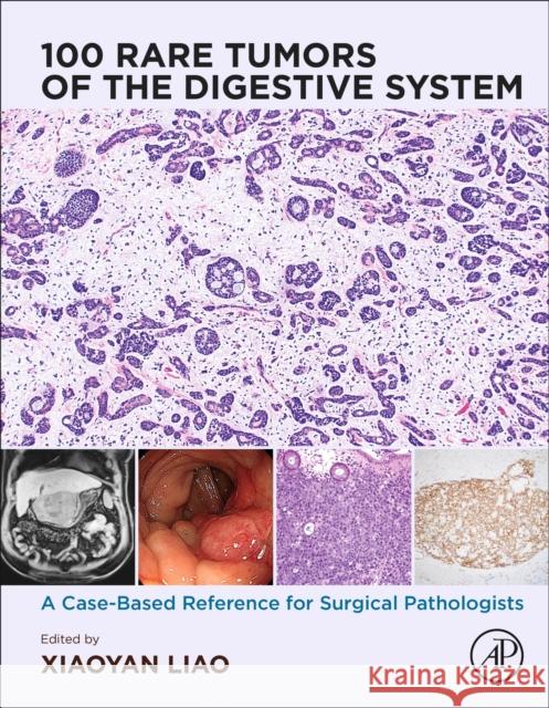 100 Rare Tumors of the Digestive System: A Case-Based Reference for Surgical Pathologists Xiaoyan Liao 9780443220616 Academic Press - książka