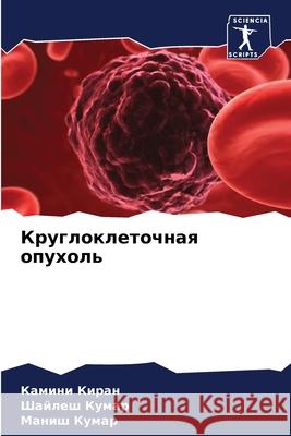 Круглоклеточная опухол&#  Киран  Кумар  Кумар 9786207863617 Sciencia Scripts - książka