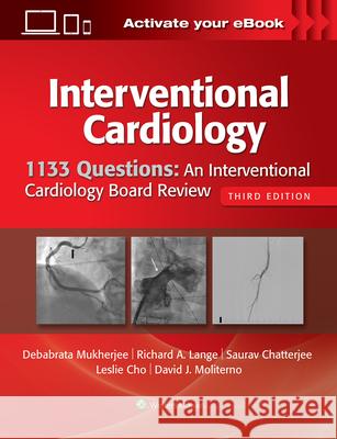 1133 Questions: An Interventional Cardiology Board Review Debabrata Mukherjee David Moliterno Leslie Cho 9781496386199 LWW - książka