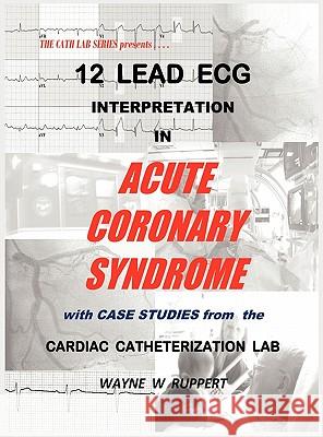 12 Lead ECG Interpretation in Acute Coronary Syndrome with Case Studies from the Cardiac Catheterization Lab Wayne W. Ruppert MD Humberto Coto MD Matthew U. Glover 9780982917206 Trigen Publishing Company - książka