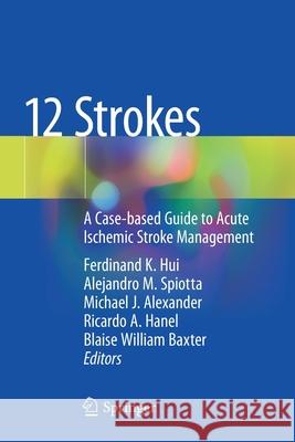 12 Strokes: A Case-Based Guide to Acute Ischemic Stroke Management Hui, Ferdinand K. 9783030568597 Springer - książka