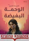 الوحمة البغيضة جاد ال 9786338320829 Kinzy Publishing Agency