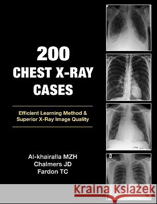 200 Chest X-Ray Cases Mudher Al-khairalla, James Chalmers, Tom Fardon 9781905006366 The London Press - książka