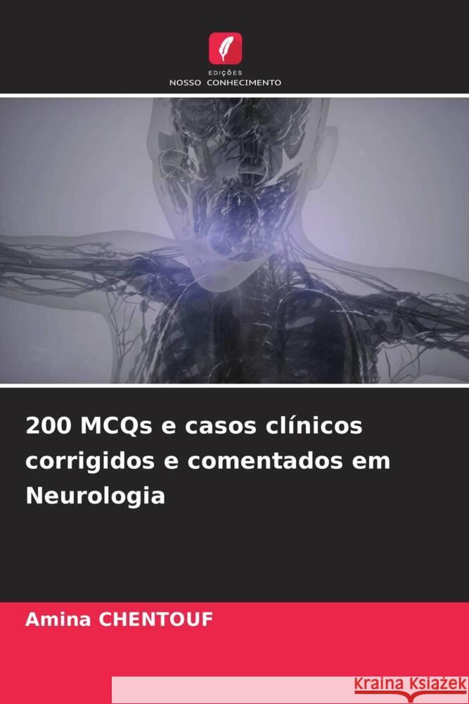 200 MCQs e casos clínicos corrigidos e comentados em Neurologia CHENTOUF, Amina 9786204900278 Edições Nosso Conhecimento - książka