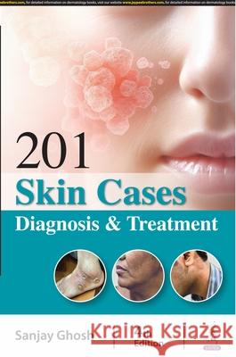 201 Skin Cases Sanjay Ghosh 9789356969216 Jaypee Brothers Medical Publishers - książka