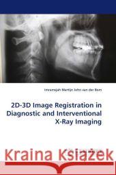 2D-3D Image Registration in Diagnostic and Interventional X-Ray Imaging Imramsjah Martijn John Van Der Bom 9783844314915 LAP Lambert Academic Publishing - książka