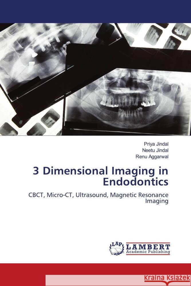 3 Dimensional Imaging in Endodontics Jindal, Priya, Jindal, Neetu, Aggarwal, Renu 9786207462407 LAP Lambert Academic Publishing - książka