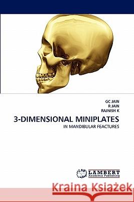 3-Dimensional Miniplates Gc Jain, R Jain, Rajnish K 9783844313901 LAP Lambert Academic Publishing - książka