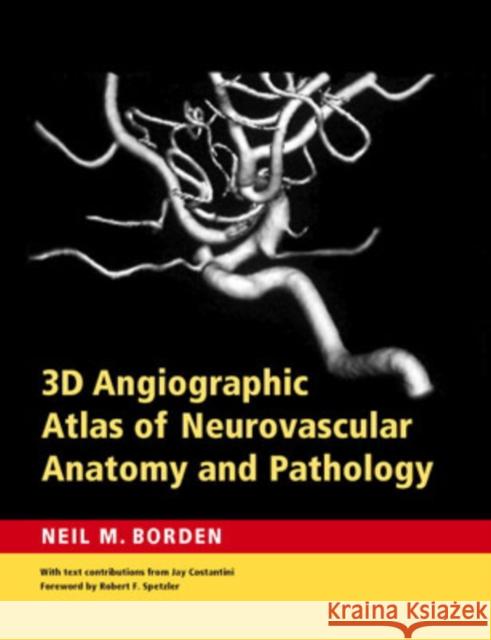 3D Angiographic Atlas of Neurovascular Anatomy and Pathology Neil M. Borden Robert F. Spetzler Jay K. Costantini 9780521856843 Cambridge University Press - książka