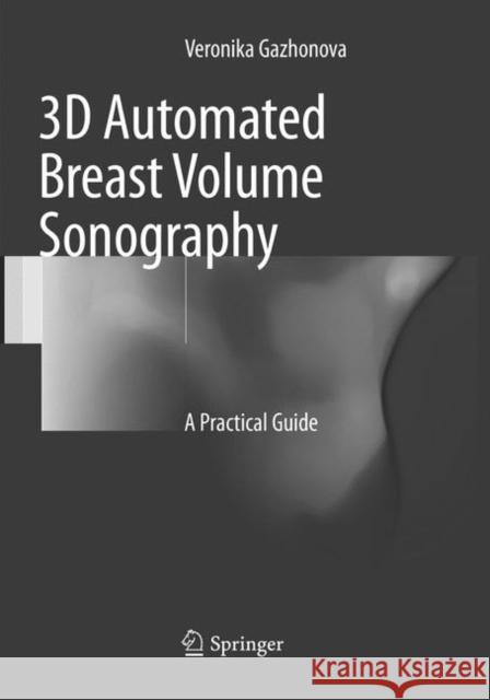 3D Automated Breast Volume Sonography: A Practical Guide Gazhonova, Veronika 9783319824697 Springer - książka