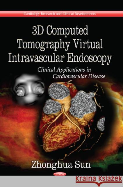 3D Computed Tomography Virtual Intravascular Endoscopy: Clinical Applications in Cardiovascular Disease Zhonghua Sun 9781626181168 Nova Science Publishers Inc - książka