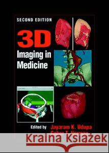 3D Imaging in Medicine, Second Edition Jayaram K. Udupa Gabor T. Herman 9780849331794 CRC Press - książka