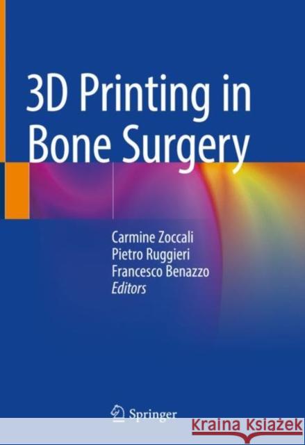 3D Printing in Bone Surgery  9783030918996 Springer International Publishing - książka