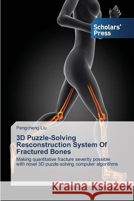 3D Puzzle-Solving Resconstruction System of Fractured Bones Liu Pengcheng 9783639662771 Scholars' Press - książka