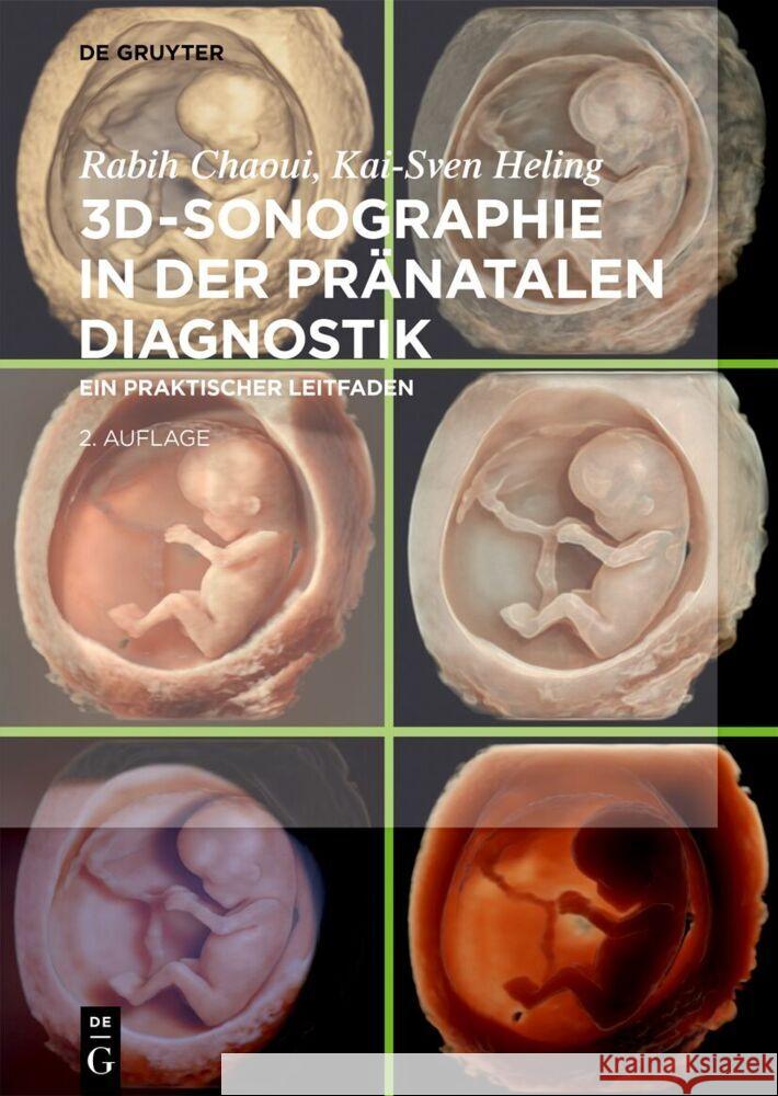 3d-Sonographie in Der Pr?natalen Diagnostik: Ein Praktischer Leitfaden Rabih Chaoui Kai-Sven Heling 9783111251448 de Gruyter - książka