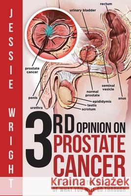 3rd Opinion on Prostate Cancer Jessie Wright 9781951886295 Book Vine Press - książka