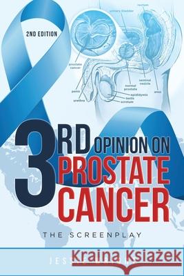 3rd Opinion on Prostate Cancer: The Screenplay Jessie Wright 9781954941649 Book Vine Press - książka