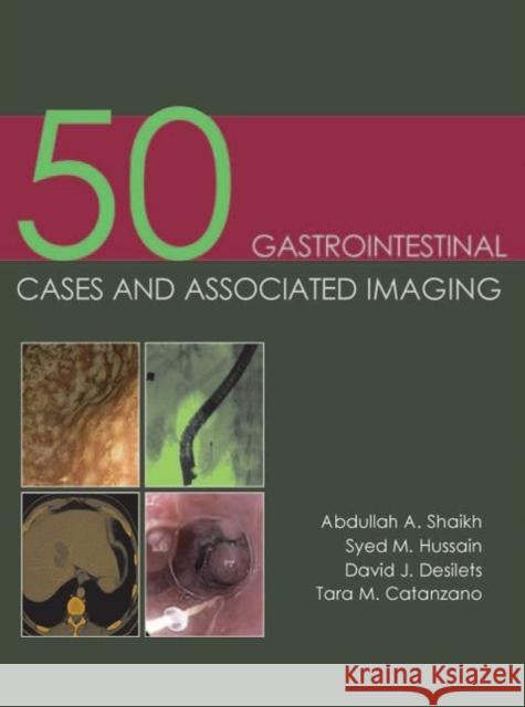 50 Gastrointestinal Cases and Associated Imaging Shaikh, Abdullah A. 9781903378854  - książka
