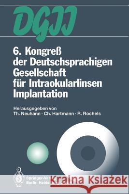 6. Kongreß Der Deutschsprachigen Gesellschaft Für Intraokularlinsen Implantation: 6. Bis 7. März 1992, München Neuhann, Thomas 9783642502699 Springer - książka