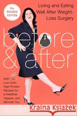 Before & After, Second Revised Edition: Living and Eating Well After Weight-Loss Surgery Leach, Susan Maria 9780062239990 0