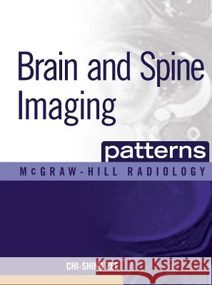 Brain and Spine Imaging Patterns: Brain & Spine Imaging Zee, Chi-Shing 9780071465410 McGraw-Hill Professional Publishing