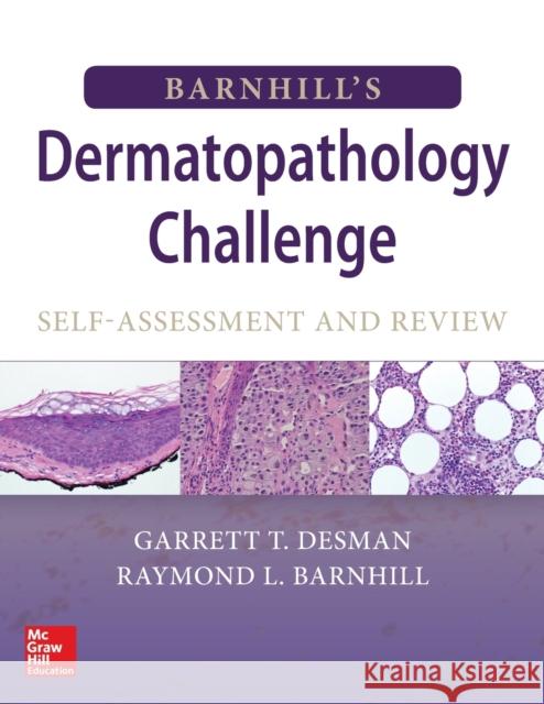 Barnhill's Dermatopathology Challenge: Self-Assessment & Review Raymond Barnhill Barnhill Raymond                         Garrett Desman 9780071489225 McGraw-Hill Education / Medical