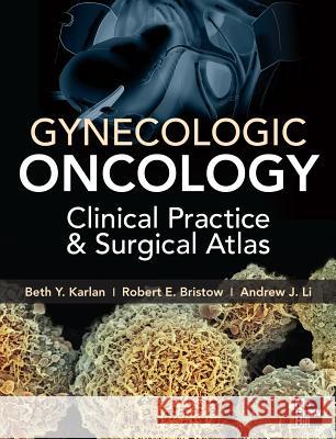 Gynecologic Oncology: Clinical Practice and Surgical Atlas Beth Karlan 9780071749268 MCGRAW-HILL PROFESSIONAL