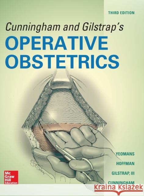 Cunningham and Gilstrap's Operative Obstetrics, Third Edition F. Cunningham Larry Gilstrap Edward Yeomans 9780071849067