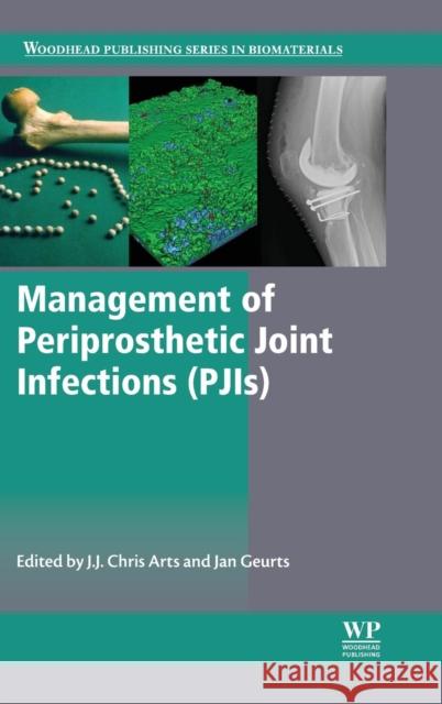 Management of Periprosthetic Joint Infections (Pjis) Arts, J. J. Chris 9780081002056 Woodhead Publishing