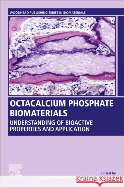 Octacalcium Phosphate Biomaterials: Understanding of Bioactive Properties and Application Insley, Gerard 9780081025116