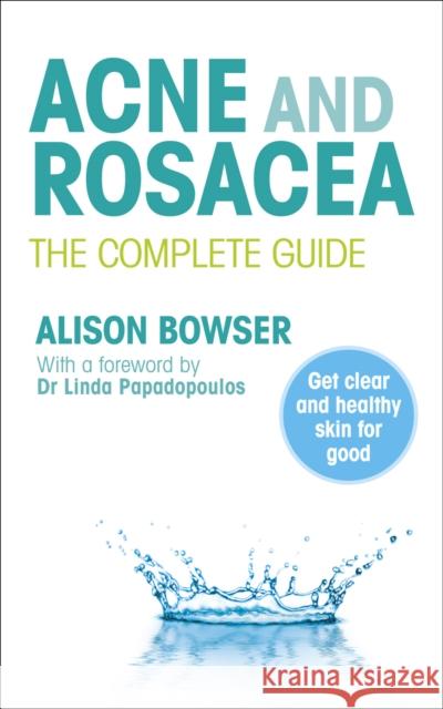 Acne and Rosacea : The Complete Guide Alison Bowser 9780091929701 0