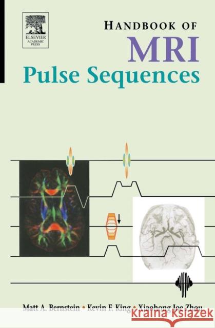 Handbook of MRI Pulse Sequences Matt A. Bernstein Kevin F. King Xiaohong Joe Zhou 9780120928613