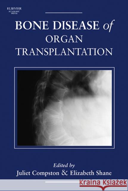 Bone Disease of Organ Transplantation Juliet Compston Juliet Compston Elizabeth Shane 9780121835026 Academic Press