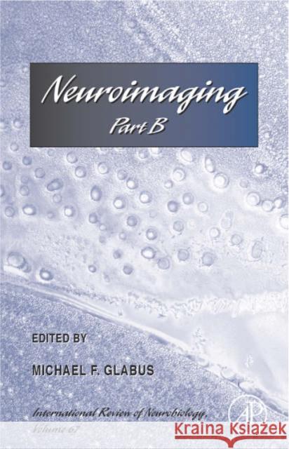 Neuroimaging Part B: Volume 67 Glabus, Michael F. 9780123668684 Academic Press