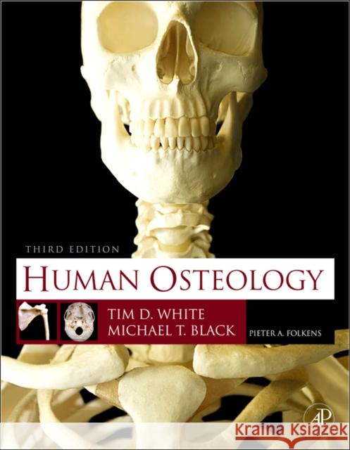 Human Osteology Tim White 9780123741349 Elsevier Science Publishing Co Inc