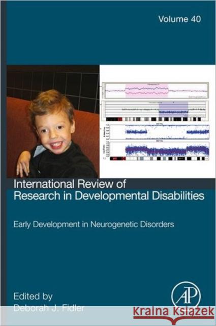 Early Development in Neurogenetic Disorders: Volume 40 Fidler, Deborah J. 9780123744784